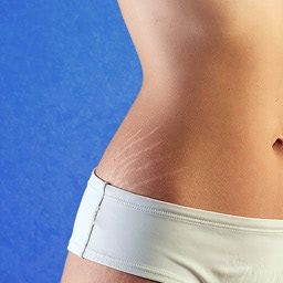 index.php?option=com_content&view=article&id=6&catid=17